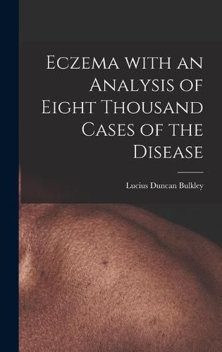 Eczema With an Analysis of Eight Thousand Cases of the Disease