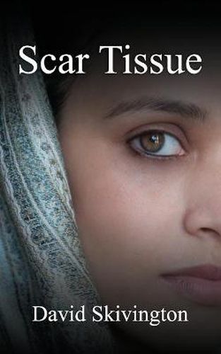 Cover image for Scar Tissue