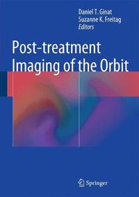 Cover image for Post-treatment Imaging of the Orbit