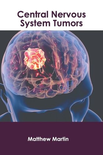 Cover image for Central Nervous System Tumors