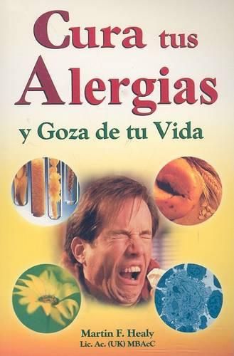 Cover image for Cura Tus Alergias y Goza de Tu Vida