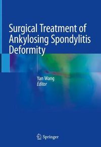 Cover image for Surgical Treatment of Ankylosing Spondylitis Deformity