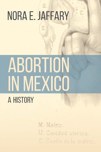 Cover image for Abortion in Mexico