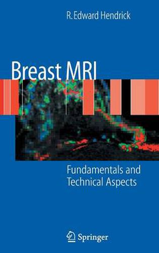 Cover image for Breast MRI: Fundamentals and Technical Aspects