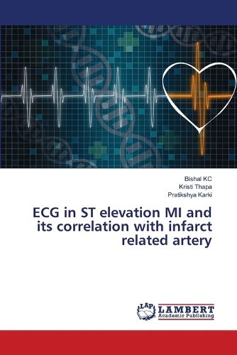 Cover image for ECG in ST elevation MI and its correlation with infarct related artery