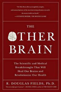 Cover image for Other Brain