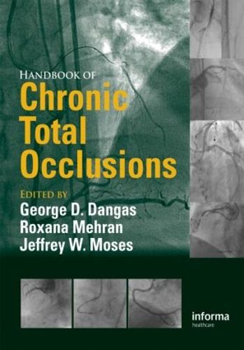 Cover image for Handbook of Chronic Total Occlusions