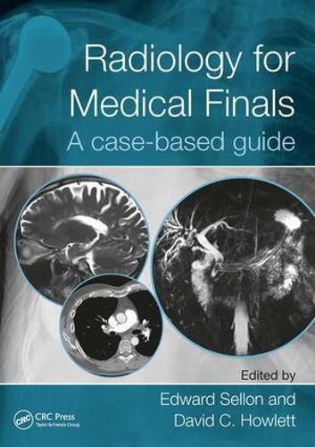 Cover image for Radiology for Medical Finals: A case-based guide