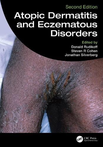 Cover image for Atopic Dermatitis and Eczematous Disorders