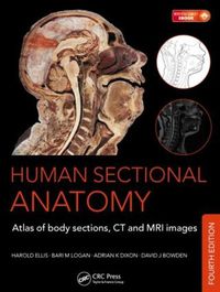 Cover image for Human Sectional Anatomy: Atlas of Body Sections, CT and MRI Images, Fourth Edition