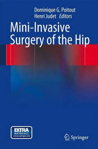 Cover image for Mini-Invasive Surgery of the Hip