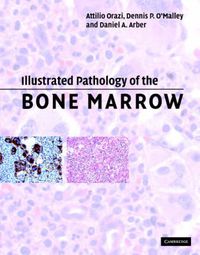 Cover image for Illustrated Pathology of the Bone Marrow