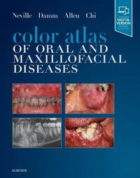 Cover image for Color Atlas of Oral and Maxillofacial Diseases