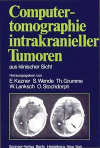 Cover image for Computertomographie intrakranieller Tumoren aus klinischer Sicht