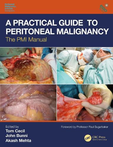 Cover image for A Practical Guide to Peritoneal Malignancy: The PMI Manual