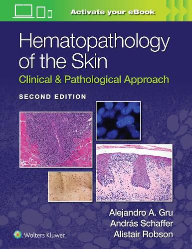 Cover image for Hematopathology of the Skin: Clinical & Pathological Approach