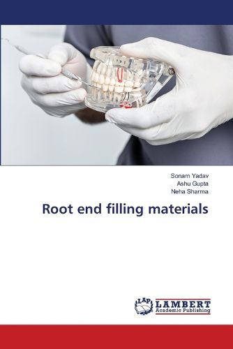 Cover image for Root end filling materials