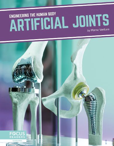 Cover image for Engineering the Human Body: Artificial Joints