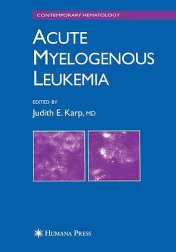 Cover image for Acute Myelogenous Leukemia