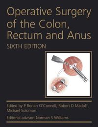 Cover image for Operative Surgery of the Colon, Rectum and Anus