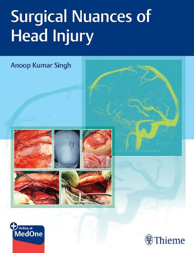 Cover image for Surgical Nuances of Head Injury