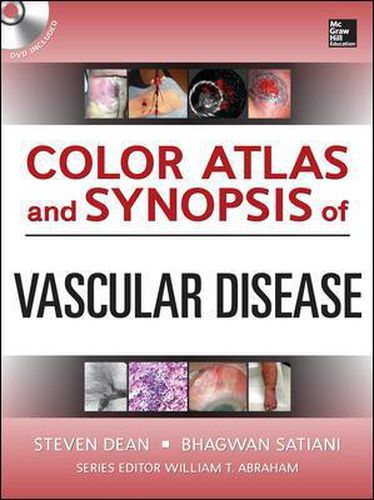Cover image for Color Atlas and Synopsis of Vascular Disease