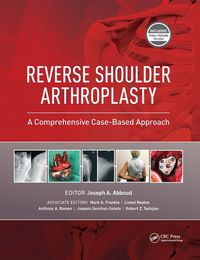 Cover image for Reverse Shoulder Arthroplasty: A Comprehensive Case-Based Approach