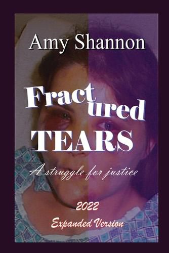 Cover image for Fractured Tears