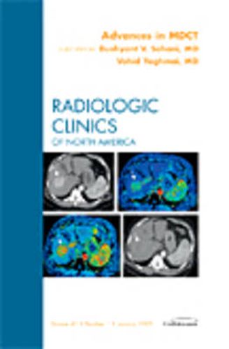 Cover image for Advances in MDCT, An Issue of Radiologic Clinics