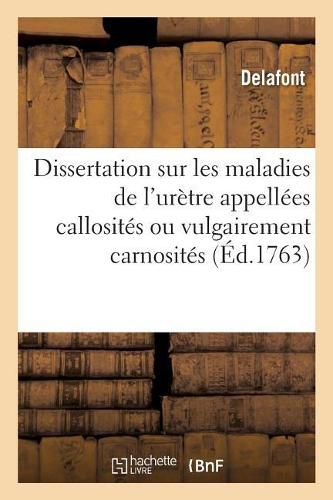 Cover image for Dissertation Sommaire Sur Les Maladies de l'Uretre Appellees Callosites Ou Vulgairement Carnosites: Et Du Moyen Sur de Les Guerir Radicalement Sans l'Usage Des Bougies