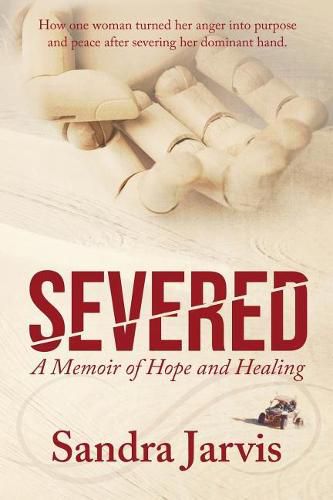 Cover image for Severed: A Memoir of Hope and Healing