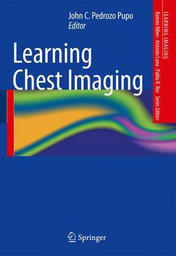 Cover image for Learning Chest Imaging