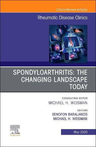 Cover image for Spondyloarthritis: The Changing Landscape Today, An Issue of Rheumatic Disease Clinics of North America