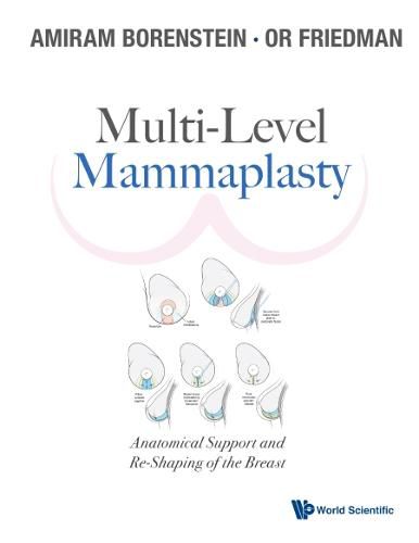 Cover image for Multi-level Mammaplasty: Anatomical Support And Re-shaping Of The Breast