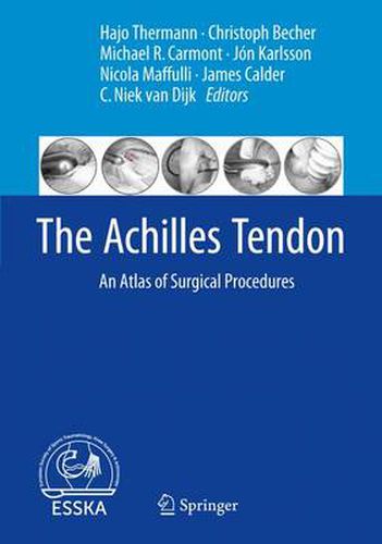 Cover image for The Achilles Tendon: An Atlas of Surgical Procedures