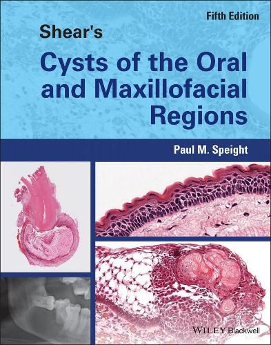 Cover image for Shear's Cysts of the Oral and Maxillofacial Region s 5th Edition