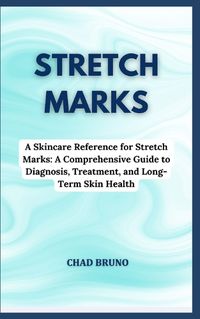Cover image for Stretch Marks