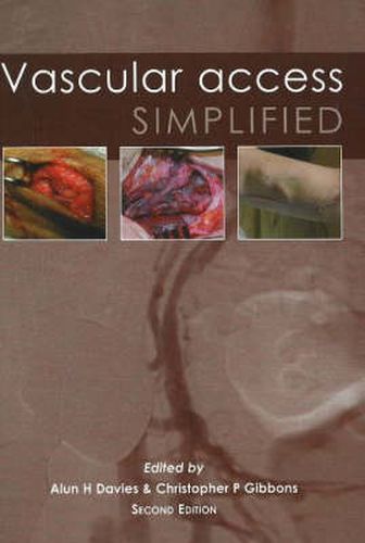 Cover image for Vascular Access Simplified: 2nd Edition