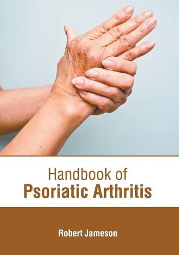 Handbook of Psoriatic Arthritis