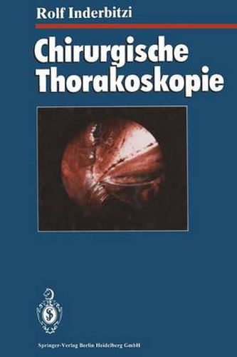 Cover image for Chirurgische Thorakoskopie