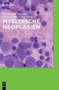 Cover image for Myeloische Neoplasien