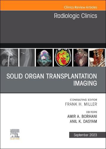 Cover image for Solid organ transplantation imaging, An Issue of Radiologic Clinics of North America: Volume 61-5