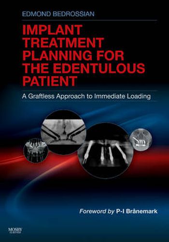 Cover image for Implant Treatment Planning for the Edentulous Patient: A Graftless Approach to Immediate Loading