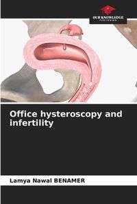 Cover image for Office hysteroscopy and infertility