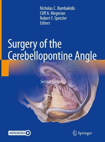 Cover image for Surgery of the Cerebellopontine Angle