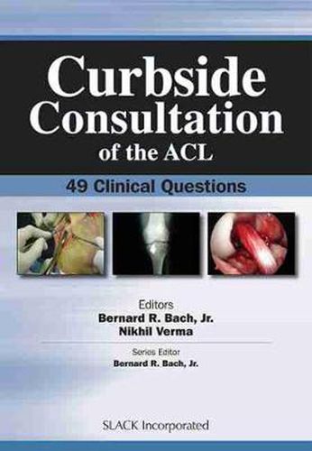 Cover image for Curbside Consultation of the ACL: 49 Clinical Questions