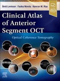 Cover image for Clinical Atlas of Anterior Segment OCT: Optical Coherence Tomography