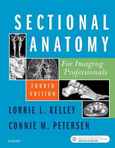 Cover image for Sectional Anatomy for Imaging Professionals