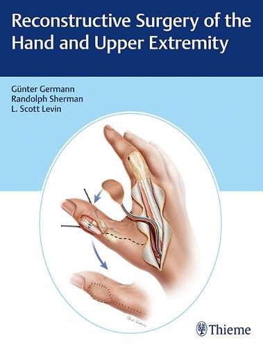 Cover image for Reconstructive Surgery of the Hand and Upper Extremity