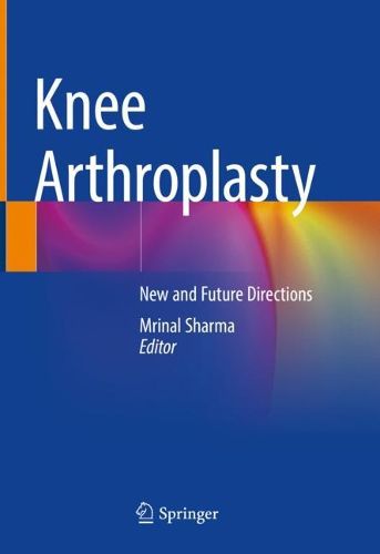 Cover image for Knee Arthroplasty: New and Future Directions